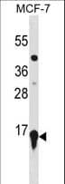 HIST2H3A Antibody (aa108-136)