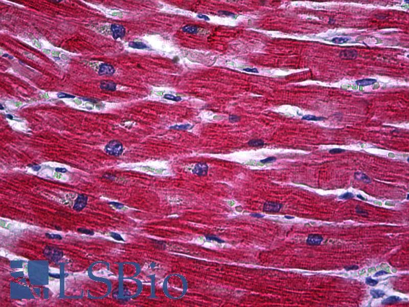 PathPlus™ TNNT2 / CTNT Antibody