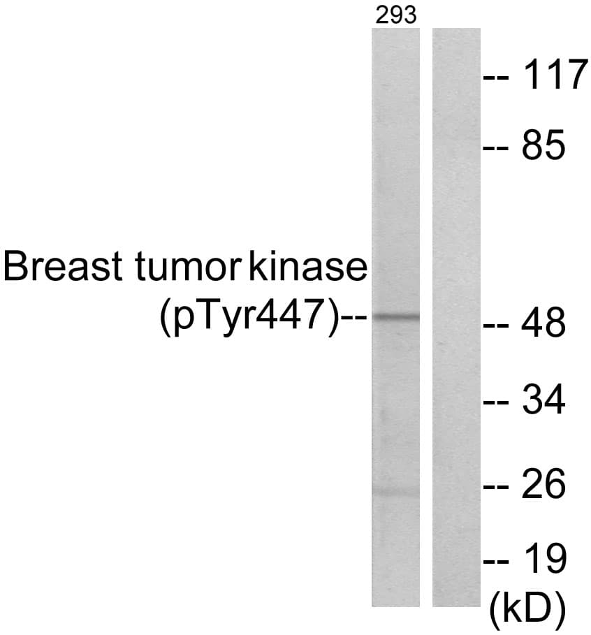 PTK6 / BRK Antibody (phospho-Tyr447)