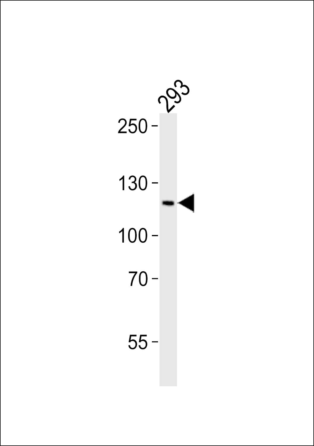 Polyclonal Rabbit anti-Human PAXIP1 / PTIP Antibody (aa2-35, WB)