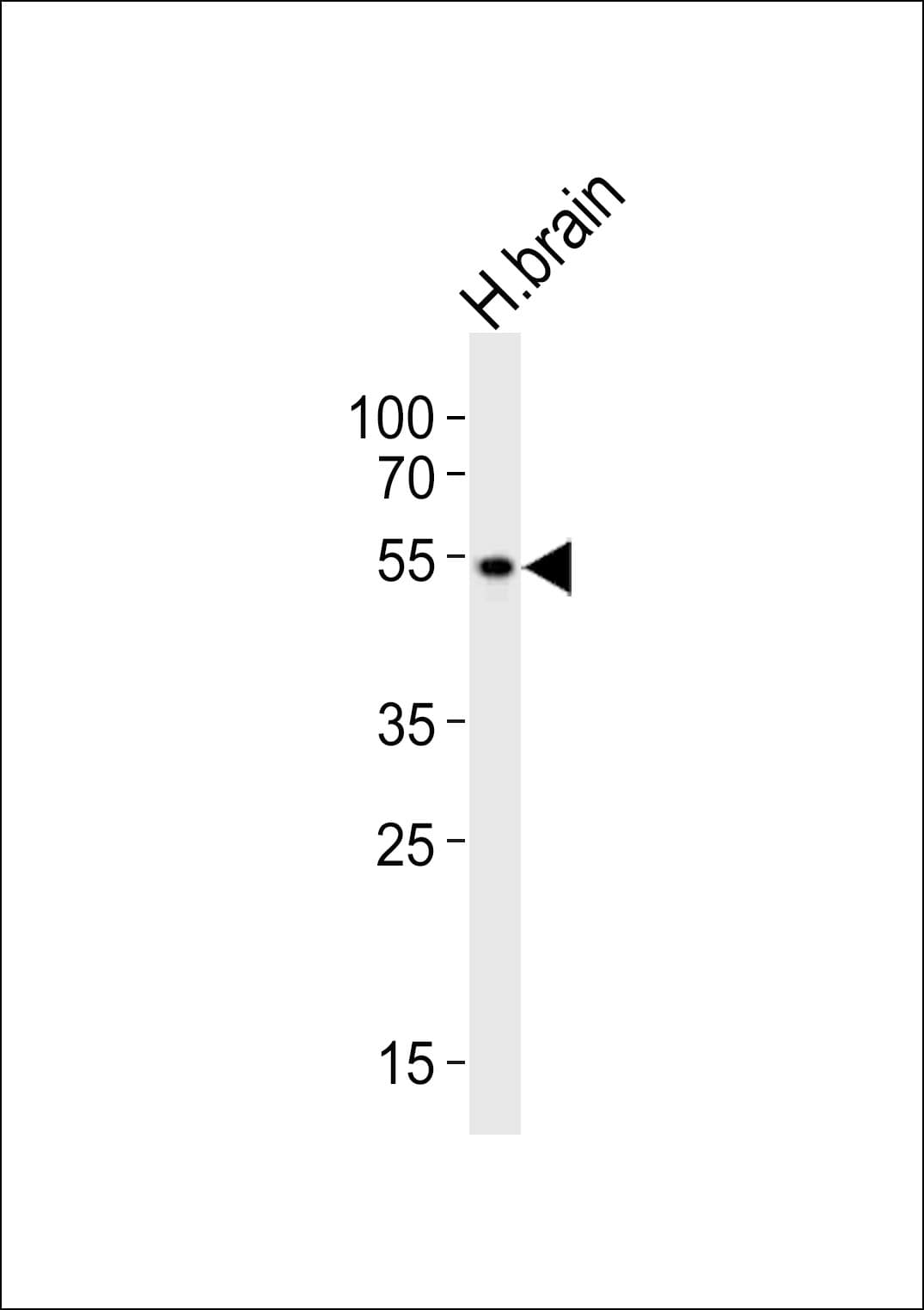 PIP4K2A / PIPK Antibody (aa329-363)