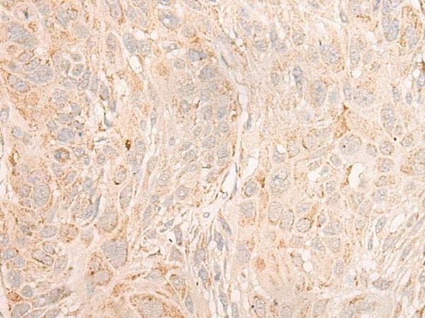 Polyclonal Rabbit anti-Human COX6C Antibody (IHC, WB)