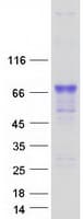 Human LRIT2 Protein (Recombinant Myc-DDK (Flag))