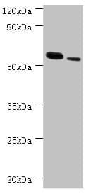 IHC-plus™ Polyclonal Rabbit anti-Human RNF8 Antibody (aa1-260, IHC, WB)