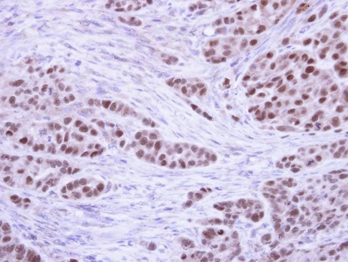 RPA2 / RFA2 / RPA34 Antibody (aa1-202)