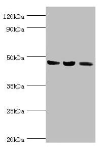 Polyclonal Rabbit anti-Human ACAT1 Antibody (aa1-145, IHC, WB)