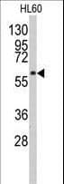 Polyclonal Rabbit anti-Human Syndapin I / PACSIN1 Antibody (aa8-38, IHC, WB)