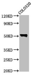 WAS / WASP Antibody