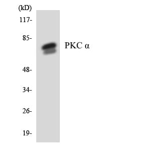 Polyclonal Rabbit anti-Human PRKCA / PKC-Alpha Antibody (aa604-653, WB)