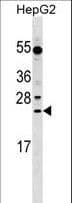 LRRC29 Antibody (aa32-60)