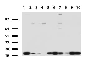 Monoclonal Mouse anti-Human NME1 / NM23 Antibody (clone UMAB93, IHC, IF, WB)