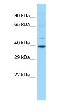Polyclonal Rabbit anti-Human IDO2 / INDOL1 Antibody (C-Terminus, IHC, WB)