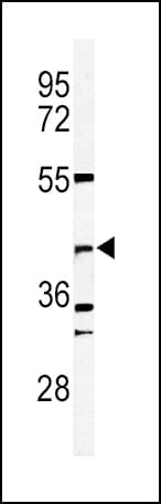 DFFB Antibody (aa1-30)