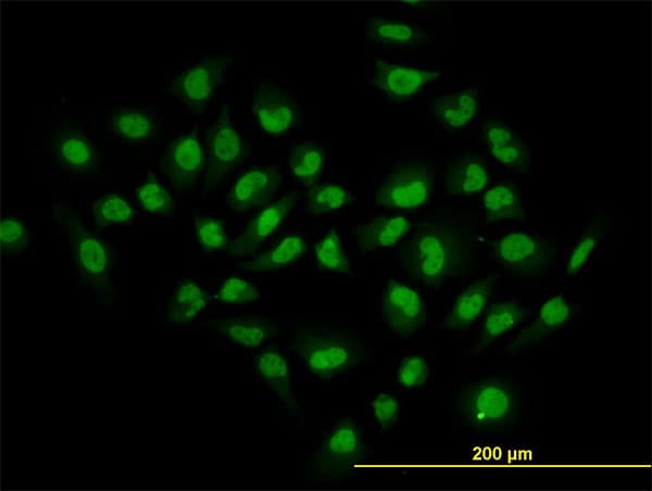 IHC-plus™ Monoclonal Mouse anti-Human HDAC1 Antibody (clone 3E1, IHC, IF, WB)