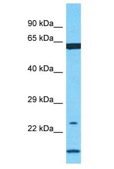 AZU1 / Azurocidin Antibody (aa84-133)