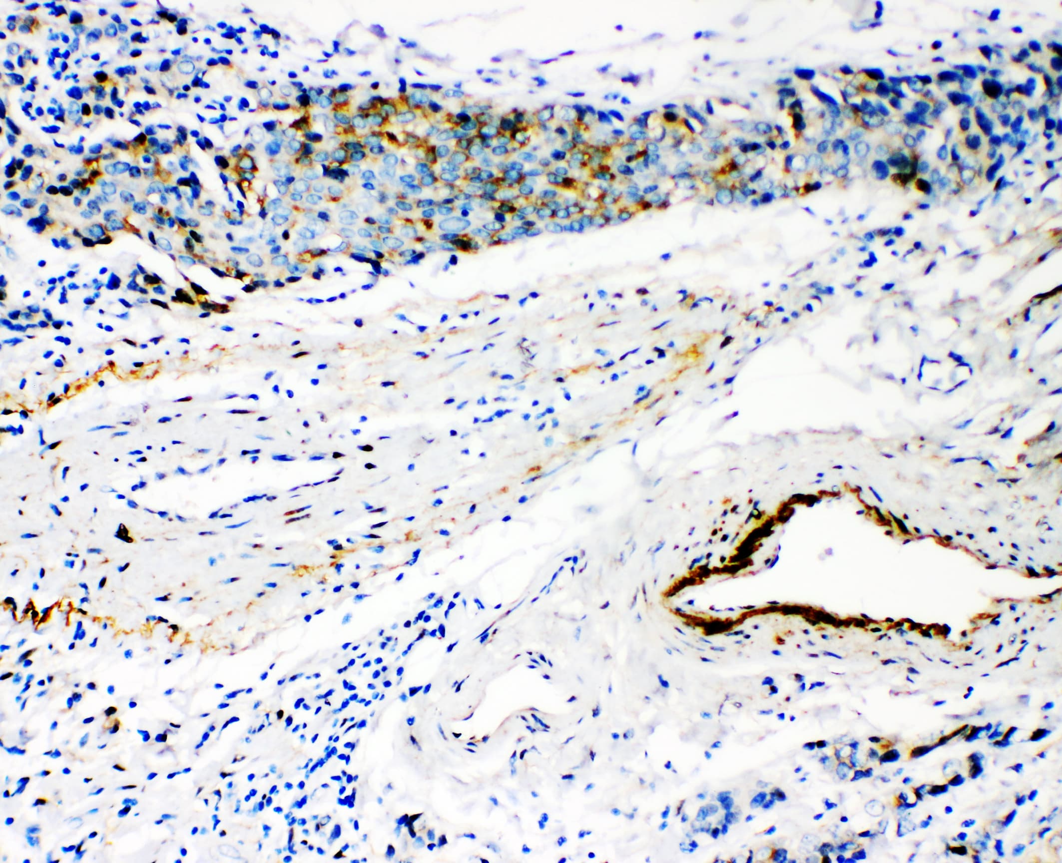 HYAL3 Antibody (aa357-371)