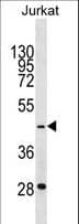 Polyclonal Rabbit anti-Human GTF3A Antibody (aa308-334, WB)