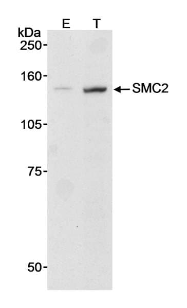 SMC2 Antibody (aa950-1000)