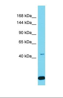 SPAG1 / TPIS Antibody (aa138-187)