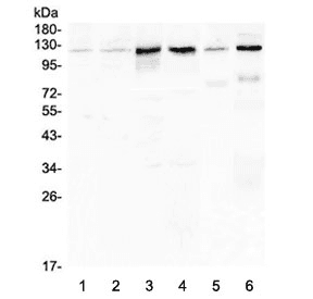 CDH3 / P-Cadherin Antibody
