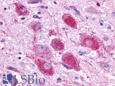 PathPlus™ ADGRE3 / EMR3 Antibody (N-Terminus)