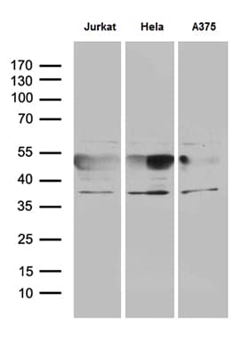 NFKBIE / IKB Epsilon Antibody (clone OTI5D11, Carrier-free)