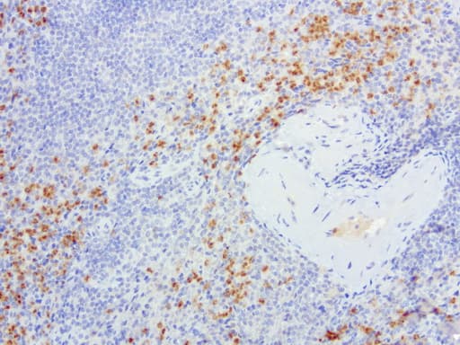 Monoclonal Mouse anti-Human S100P Antibody (clone UMAB24, IHC, IF, WB)