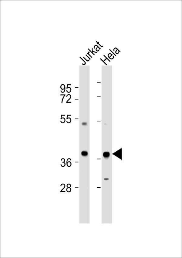 PRKAG1 / AMPK Gamma 1 Antibody