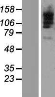 TBC1D9B Protein (Over-Expression Lysate Myc-DDK (Flag))