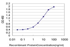 PRKCZ / PKC-Zeta Antibody (clone 2D1)