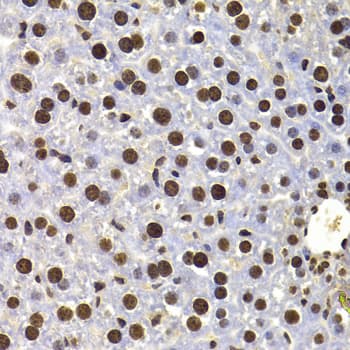 Polyclonal Rabbit anti-Human HIRIP3 Antibody (IHC, IF, WB)
