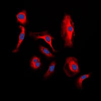 WNT1 Antibody (C-Terminus)