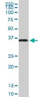 Osteonectin / SPARC Antibody (clone 1B2)