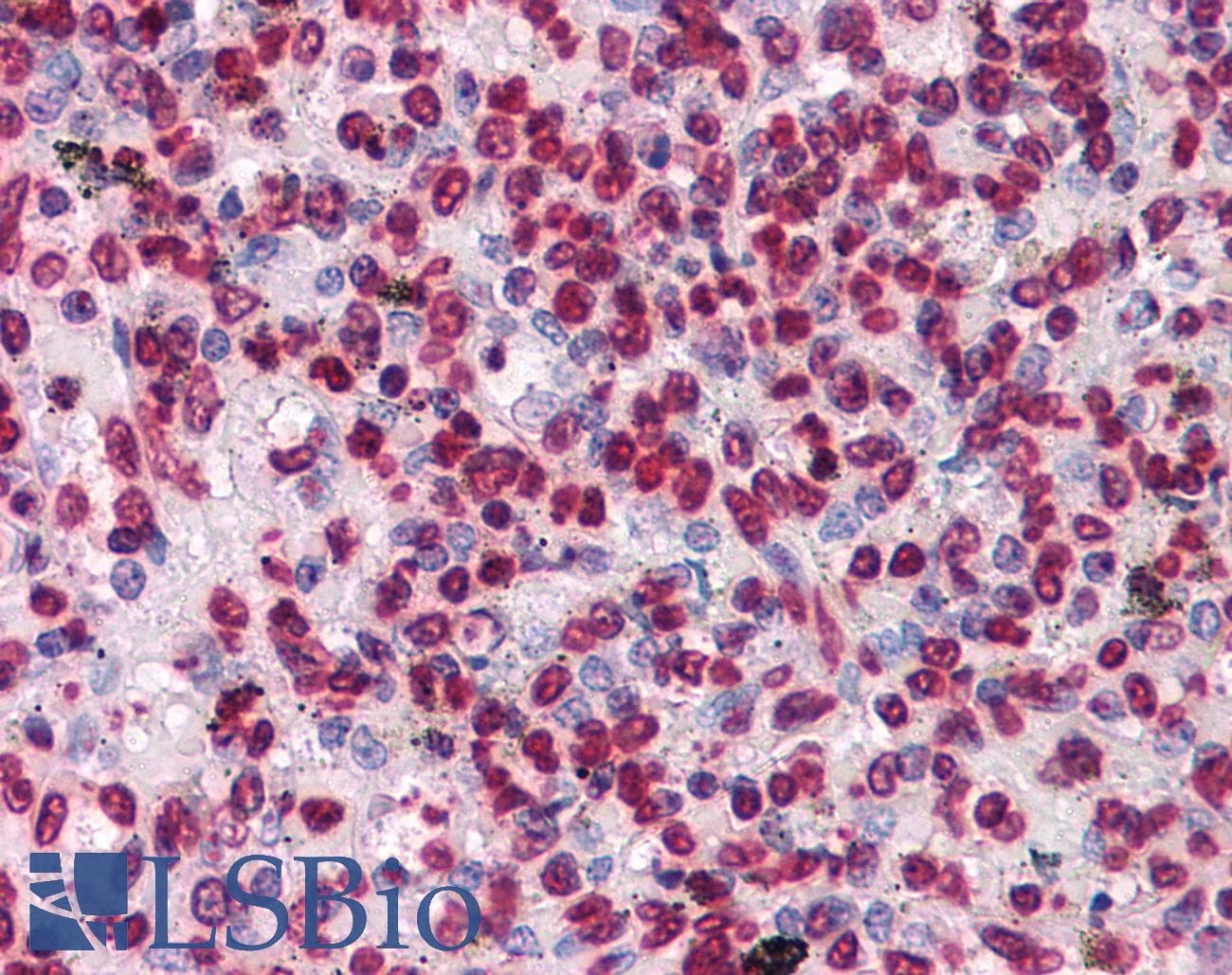IHC-plus™ Monoclonal Mouse anti-Human HIPK1 Antibody (clone 1D6, IHC)