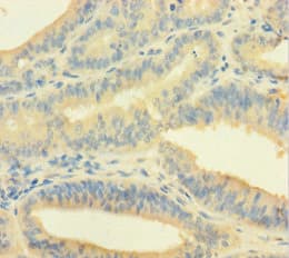 EME1 Antibody (aa1-583)