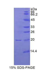 Rat IFN Beta / Interferon Beta Protein (Recombinant His)