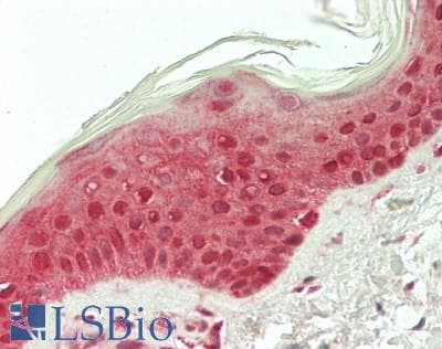 IHC-plus™ Calgizzarin / S100A11 Antibody