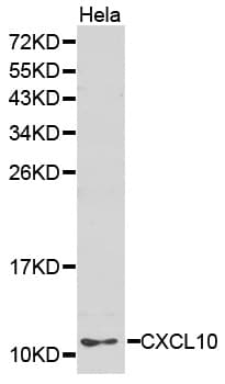 Polyclonal Rabbit anti-Human CXCL10 / IP-10 Antibody (IHC, WB)