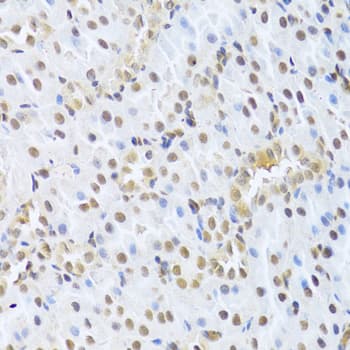 Polyclonal Rabbit anti-Human CDK4 Antibody (IHC, IF, WB)