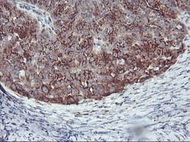 SQSTM1 Antibody (clone OTI5D5)