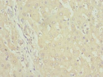 FAM176A / TMEM166 Antibody