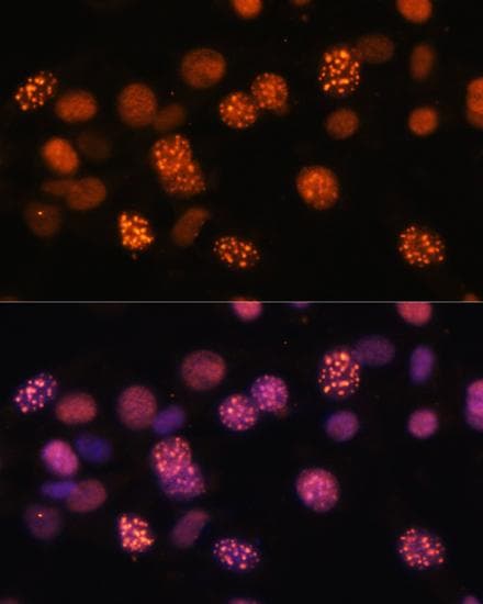 DNMT / DNMT1 Antibody