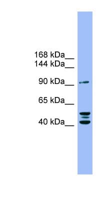 ENPP2 / Autotaxin Antibody (aa215-264, Biotin)