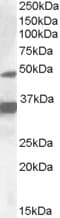 IHC-plus™ NR1I2 / PXR Antibody (aa406-420)
