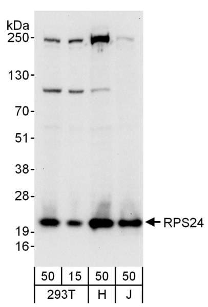 RPS24 / Ribosomal Protein S24 Antibody (aa83-133)