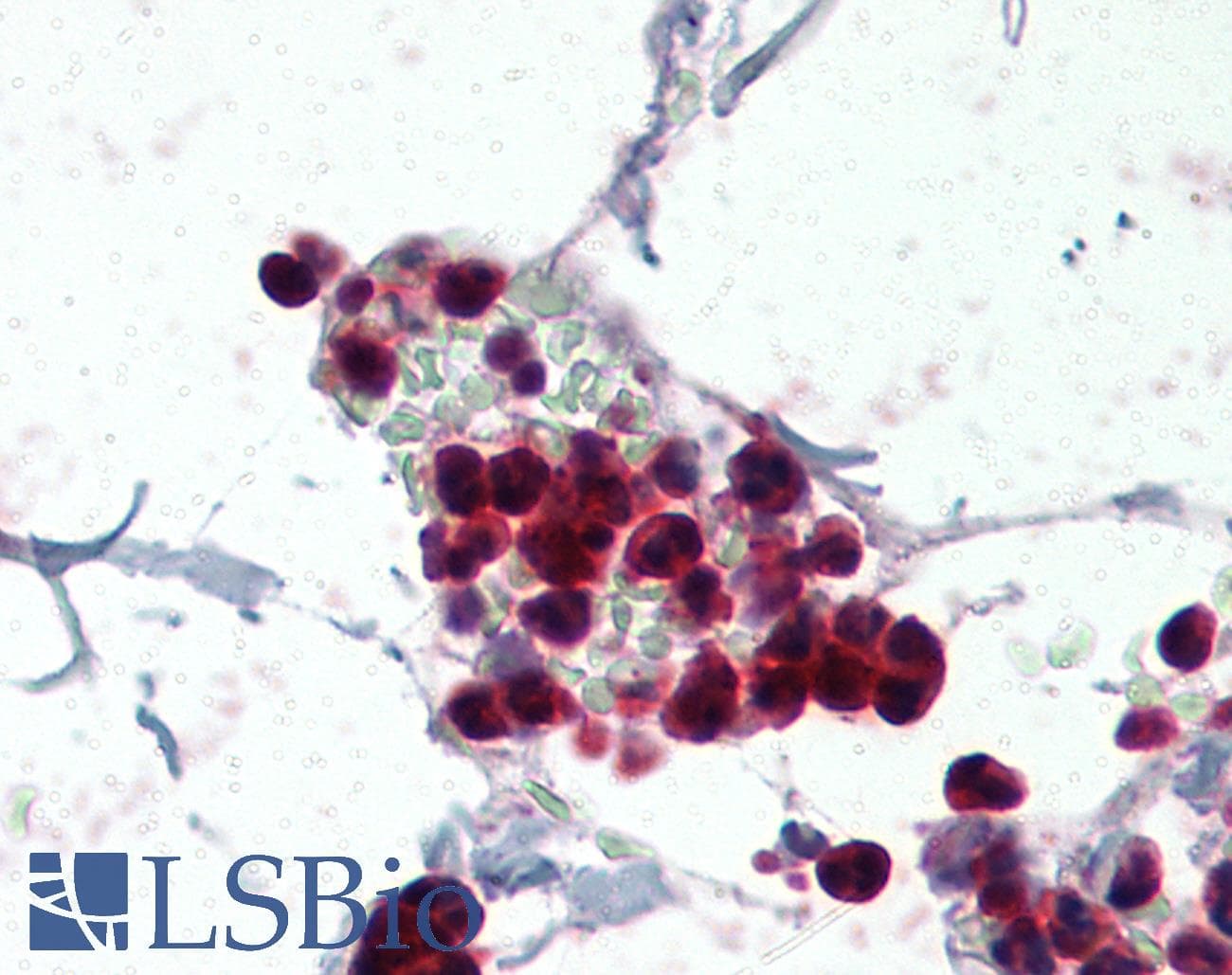 IHC-plus™ Polyclonal Goat anti-Human NCF1 / p47phox / p47 phox Antibody (aa378-390, IHC, IF, WB)