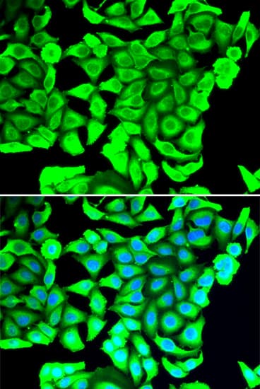 DCD / Dermcidin Antibody