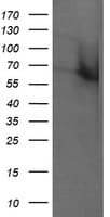 RTKN / Rhotekin Antibody (clone OTI1A4)