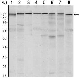 Monoclonal Mouse anti-Human ESET / SETDB1 Antibody (clone 5H6A12, IF, WB)