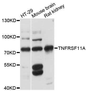 TNFRSF11A / RANK Antibody